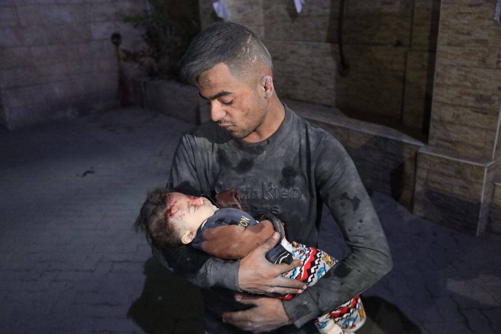 Un hombre palestino con un niño herido tras los nuevos bombardeos del Ejército de Israel sobre la Franja de Gaza en Palestina