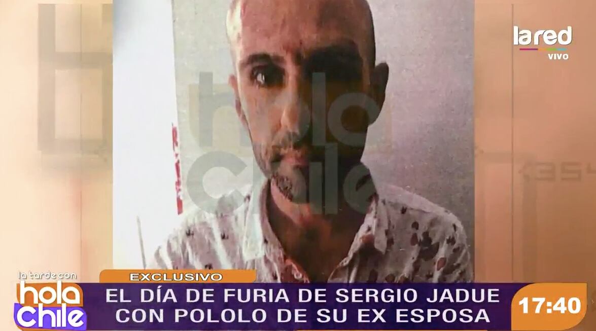 Sergio Jadue ensangrentado