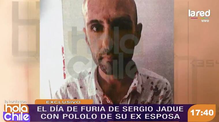 Sergio Jadue ensangrentado