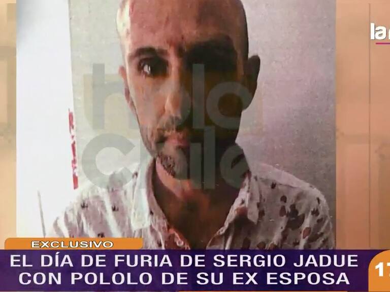 Sergio Jadue ensangrentado