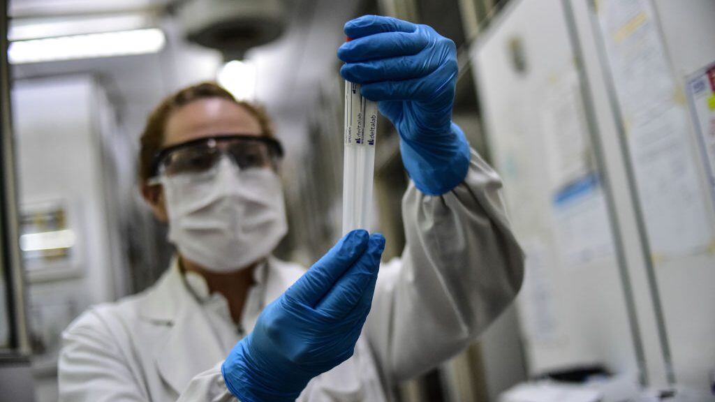 BUENOS AIRES, ARGENTINA - APRIL 28: Biochemist Daniela Beatriz Ori manipulates swab samples to make a real time polymerase chain reaction (RT-PCR) analysis for COVID-19 testing at the biochemistry lab of Central Navy Hospital Dr. Pedro Malloon April 28, 2020 in Buenos Aires, Argentina. The hospital, which is treating COVID-19 patients, has capacity to process up to 36 swab samples a day. (Photo by Amilcar Orfali/Getty Images)