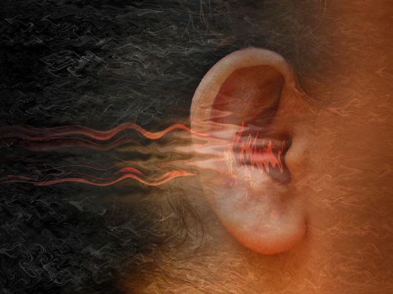 Experto advierte sobre el impacto del ruido en el cerebro y revela tres formas simples de evitarlo