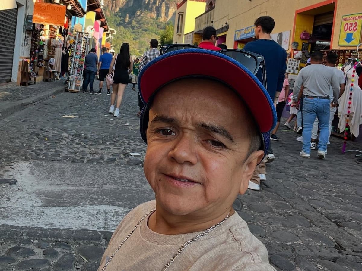 Miguelito revela su dura experiencia en circo peruano: sufría maltratos y lo tenían encerrado