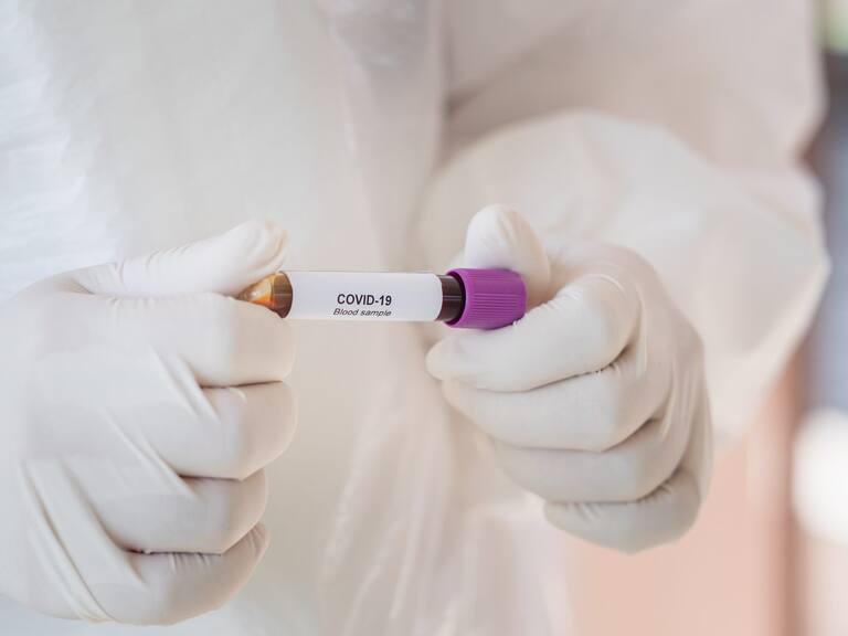 Cámara de la Innovación Farmacéutica y Covid-19: La vacuna podría estar dentro de los próximos 12, 18 meses