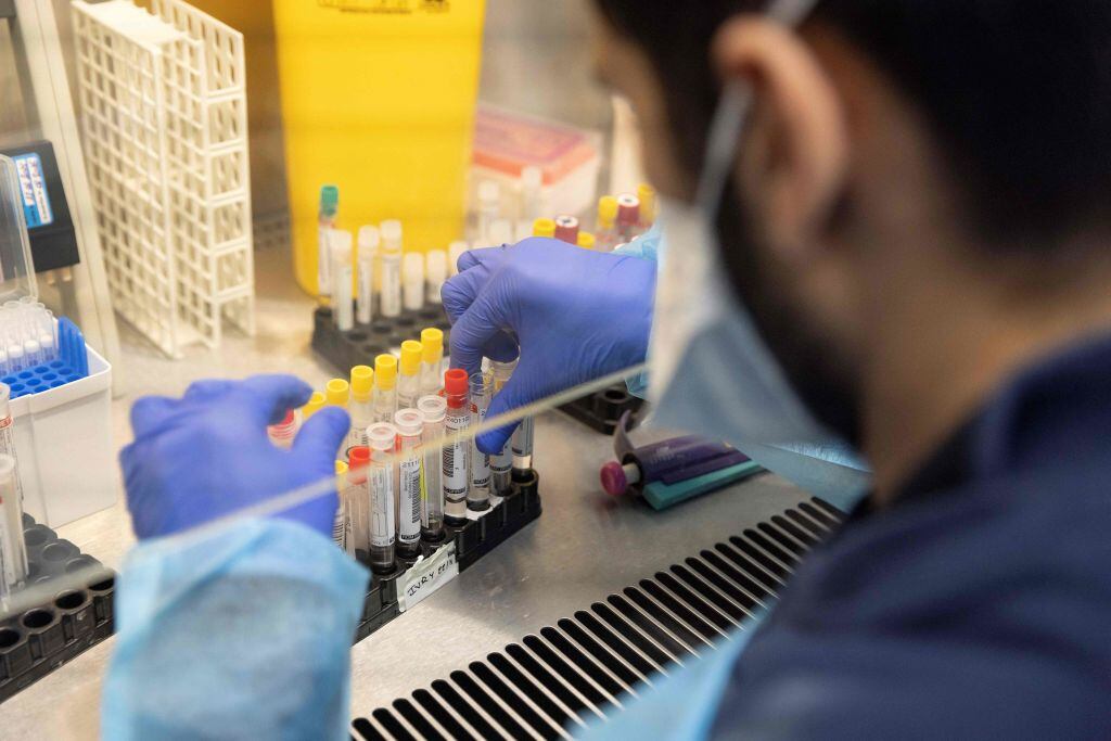 En un laboratorio francés revisan los test para detectar el covid-19