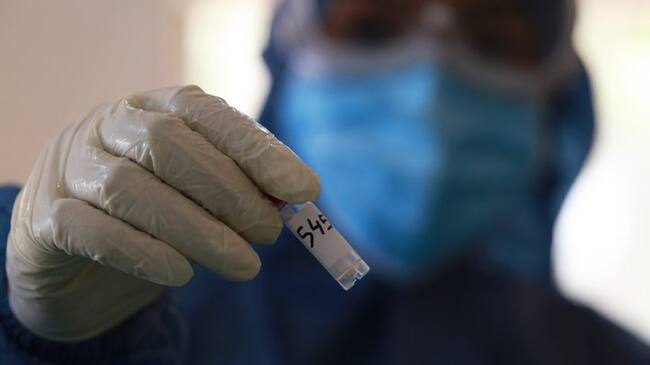 Dhaka, Bangladesh – June 24, 2020: A medical official wearing protective stuffs as she holds up COVID-19 testing kit after collected sample from a resident to test for the COVID-19 coronavirus at a hospital in Dhaka, Bangladesh on June 24, 2020.