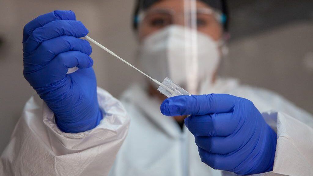 07 de Enero de 2022/SANTIAGO
Operativo exámenes PCR para la detección del Virus Covid-19 y trazabilidad. Ministerio de Salud informa 3.799 casos nuevos de COVID-19, con una positividad de 4,75% en las últimas 24 horas a nivel nacional, con 74.482 exámenes, PCR y test de antígeno.
FOTO BASTIÁN CIFUENTES /AGENCIAUNO