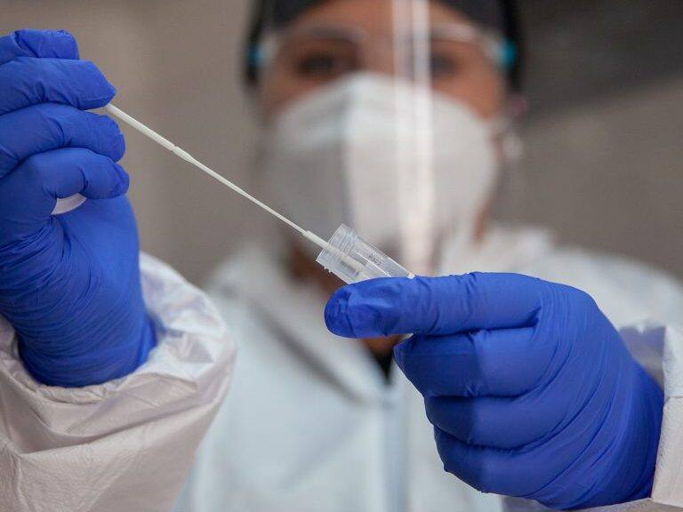 07 de Enero de 2022/SANTIAGO
Operativo exámenes PCR para la detección del Virus Covid-19 y trazabilidad. Ministerio de Salud informa 3.799 casos nuevos de COVID-19, con una positividad de 4,75% en las últimas 24 horas a nivel nacional, con 74.482 exámenes, PCR y test de antígeno.
FOTO BASTIÁN CIFUENTES /AGENCIAUNO