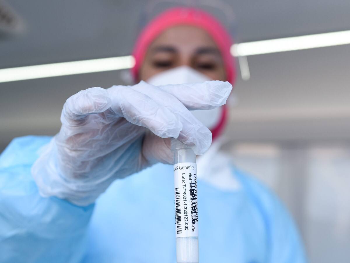 Informe Epidemiológico: se registran más de 147 mil casos activos a nivel nacional