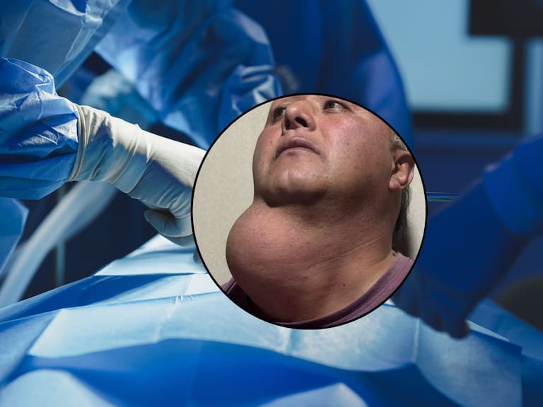 Después de 17 años en lista de espera: fijan cirugía urgente para paciente con tumor en el cuello en Victoria