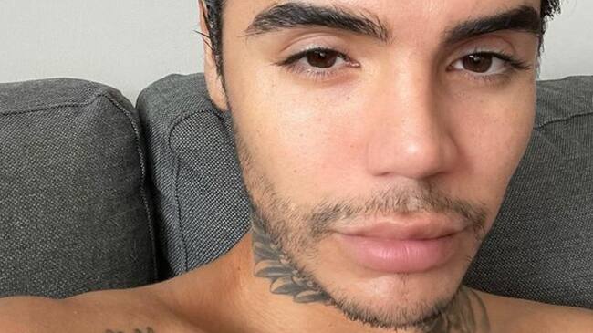 Clínica responde a Leo Méndez Jr tras ser acusados de realizar mal una cirugía estética