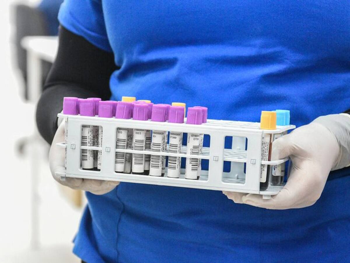 Minsal informó 1.926 nuevos casos y ya son 395.708 los contagiados con coronavirus en Chile