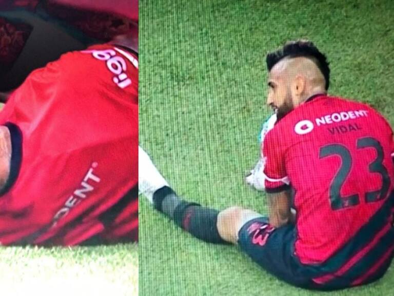 Arturo Vidal salió lesionado en duelo entre Athletico Paranaense y Fluminense por el Brasileirao