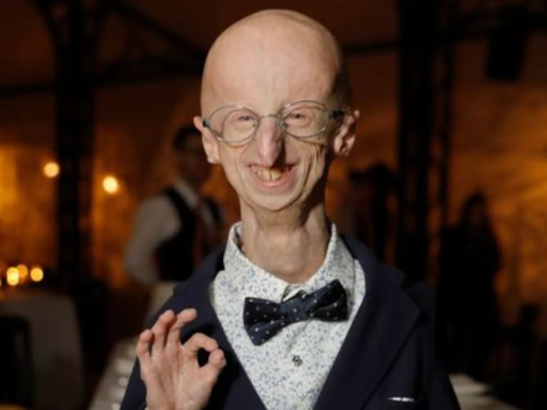 Era la persona más longeva con progeria: muere Sammy Basso a los 28 años