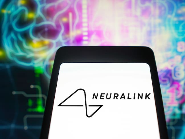 Elon Musk asegura que paciente con chip cerebral de Neuralink logró mover el cursor de un mouse con el pensamiento