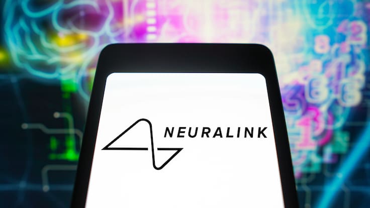 Elon Musk asegura que paciente con chip cerebral de Neuralink logró mover el cursor de un mouse con el pensamiento