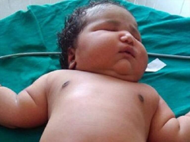 Mujer de 19 años en India tuvo una bebé de 6,8 kilos