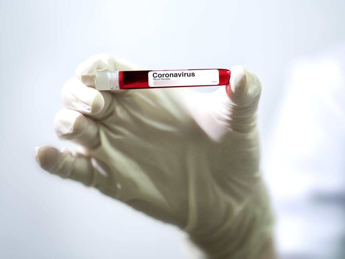Confirmaron segundo caso de coronavirus en Chile