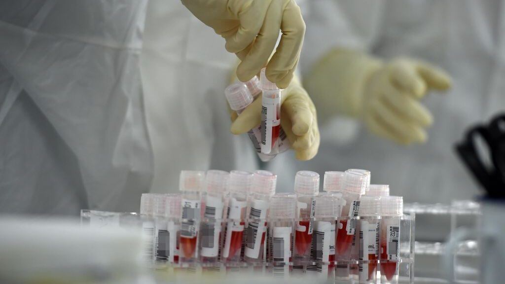 Inteligencia británica aseguró que es posible que el covid-19 haya salido de un laboratorio chino