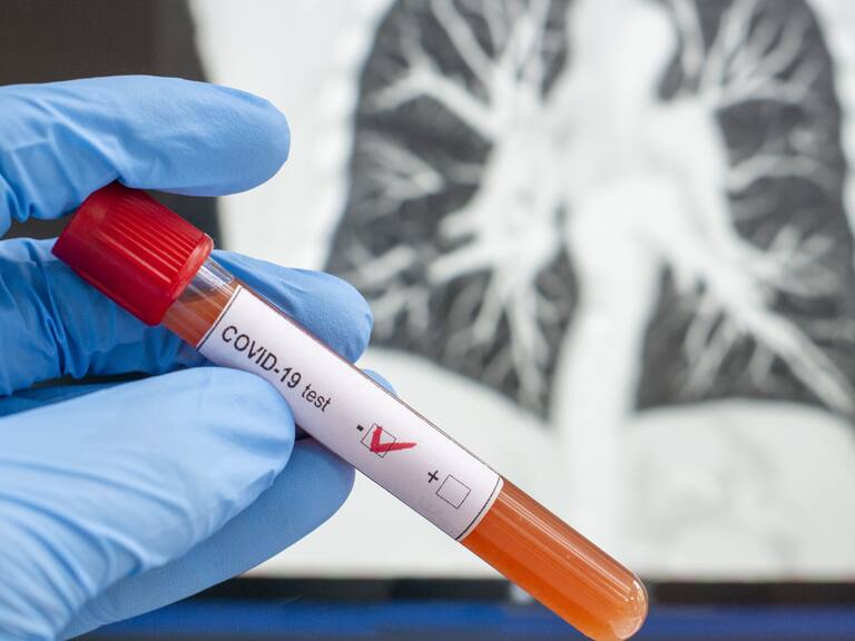 Minsal fijó precio máximo de $25 mil a examen PCR