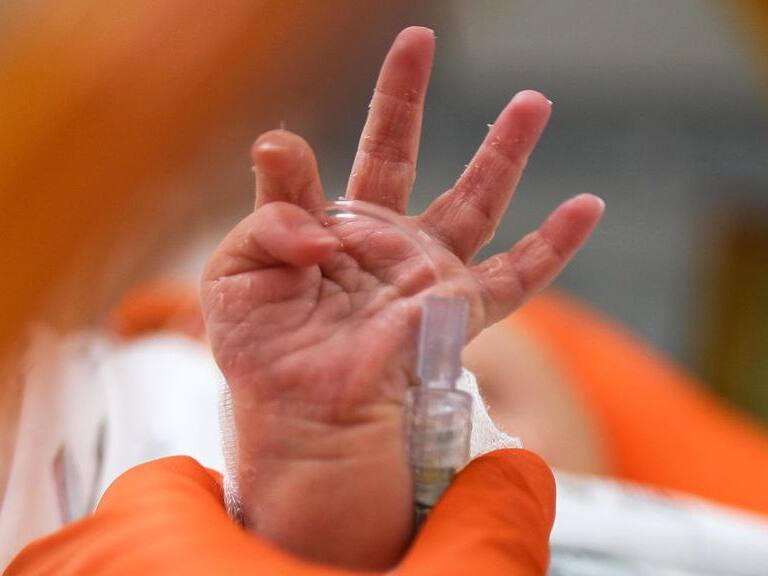 MOSCOW, RUSSIA - MAY 29, 2020: An infant treated in the children's intensive care unit of a temporary medical facility established for COVID-19 patients at Moscow City Clinical Hospital No 15 (Filatov Hospital). Sergei Bobylev/TASS (Photo by Sergei BobylevTASS via Getty Images)
