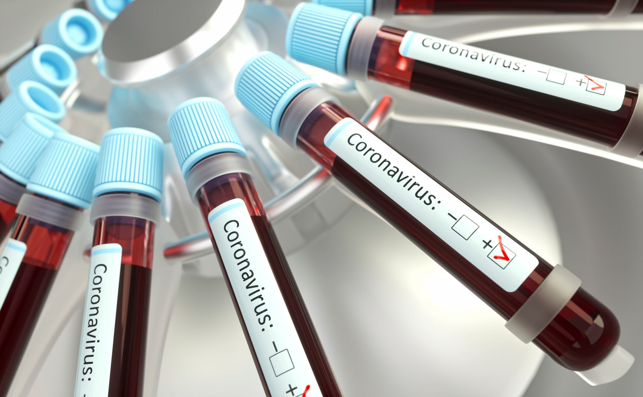 Coronaviruses research, conceptual illustration. Vials of blood in a centrifuge being tested for coronavirus infection.