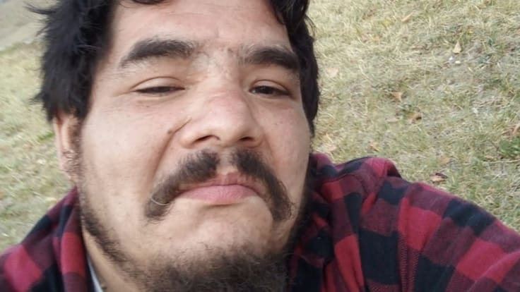 Desoladora conmemoración: Confirman muerte de víctima de trauma ocular justo en un nuevo aniversario del Estallido Social