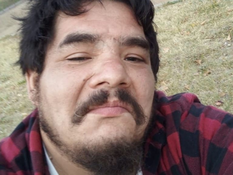 Desoladora conmemoración: Confirman muerte de víctima de trauma ocular justo en un nuevo aniversario del Estallido Social