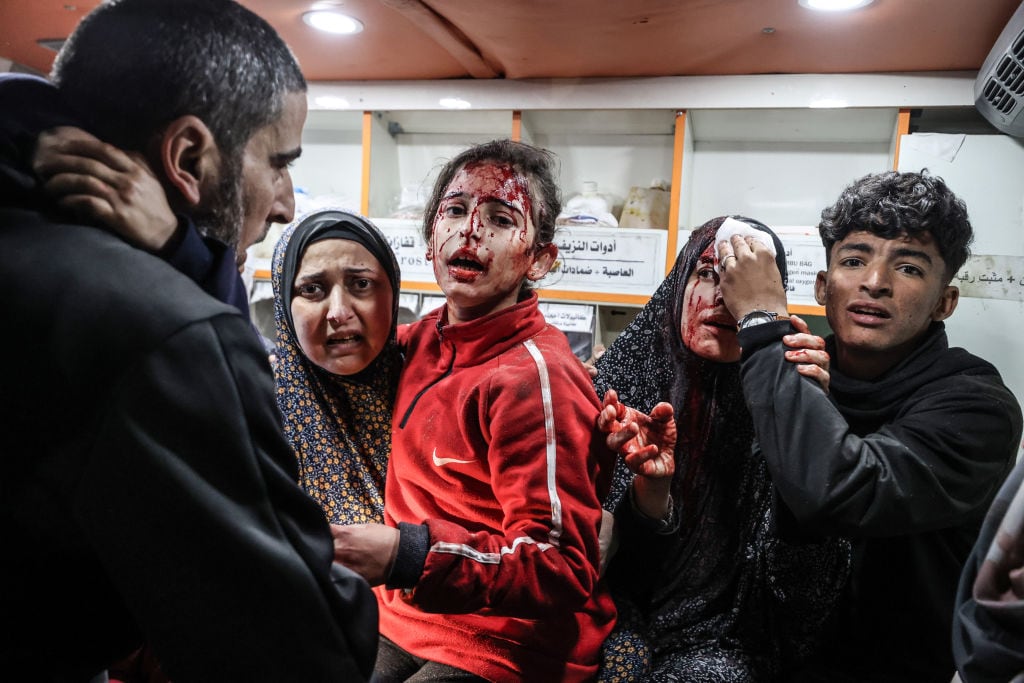 Un niño y una mujer son atendidos en la Franja de Gaza, luego de sufrir heridas por los bombardeos de Israel en contra del enclave palestino.