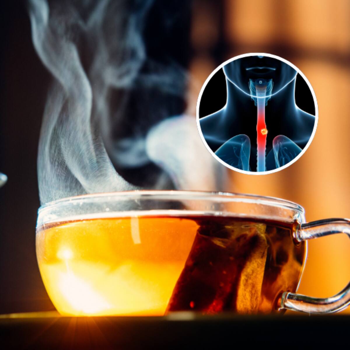 Este es el tipo de cáncer que puedes desarrollar si bebes demasiadas bebidas calientes, según expertos