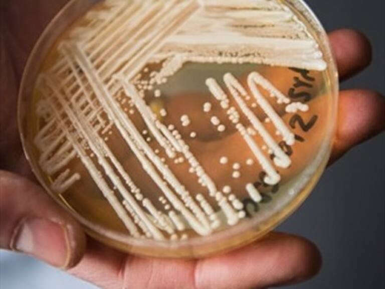 Confirman primer caso en Chile de paciente con hongo Candida auris