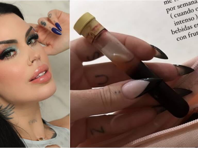 “Por eso soy una muñeca de porcelana”: modelo argentina genera polémica por contar que toma su propia sangre para “mantenerse joven”