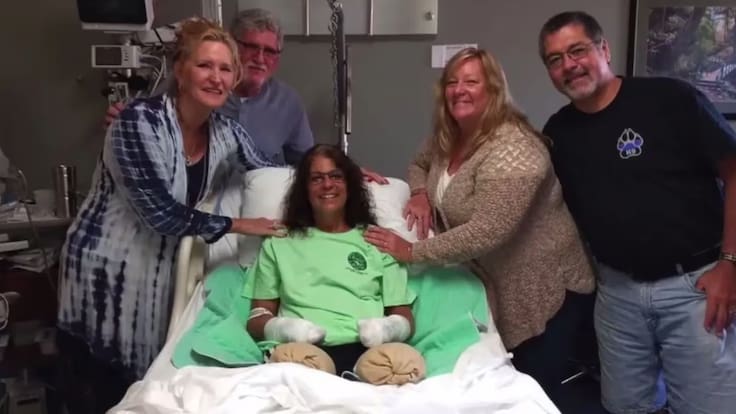 Un gesto del amor más puro casi la mata: la historia de una mujer que perdió brazos y piernas por interactuar con su mascota