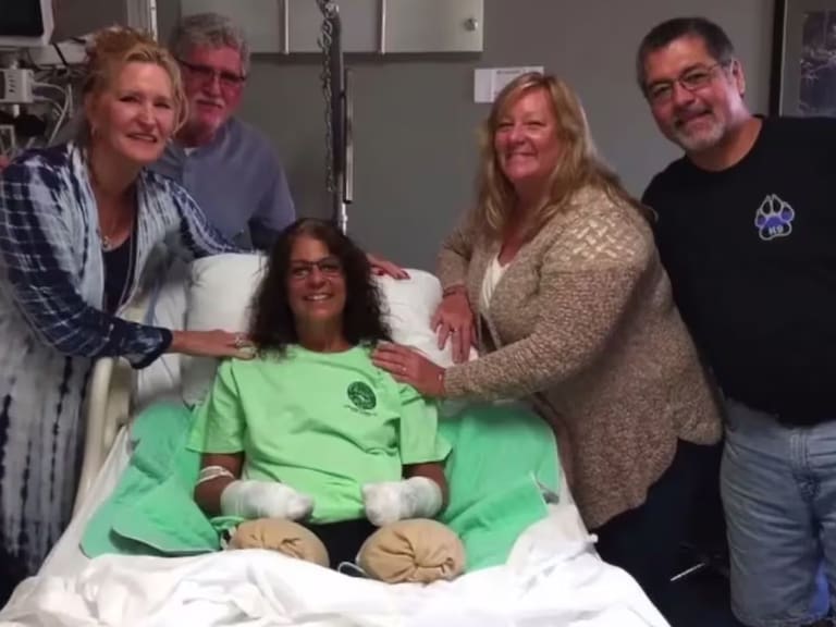 Un gesto del amor más puro casi la mata: la historia de una mujer que perdió brazos y piernas por interactuar con su mascota