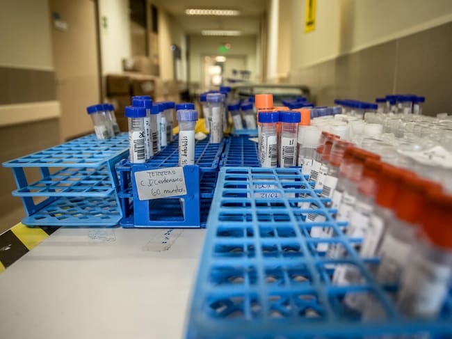 Muestras de PCR (referencial)