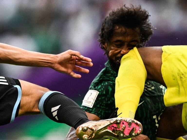 Crudo diagnóstico: defensor de Arabia Saudita sufrió fracturas faciales y en la mandíbula