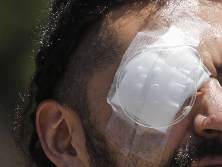 Ocular, 1024x576 jpg ok