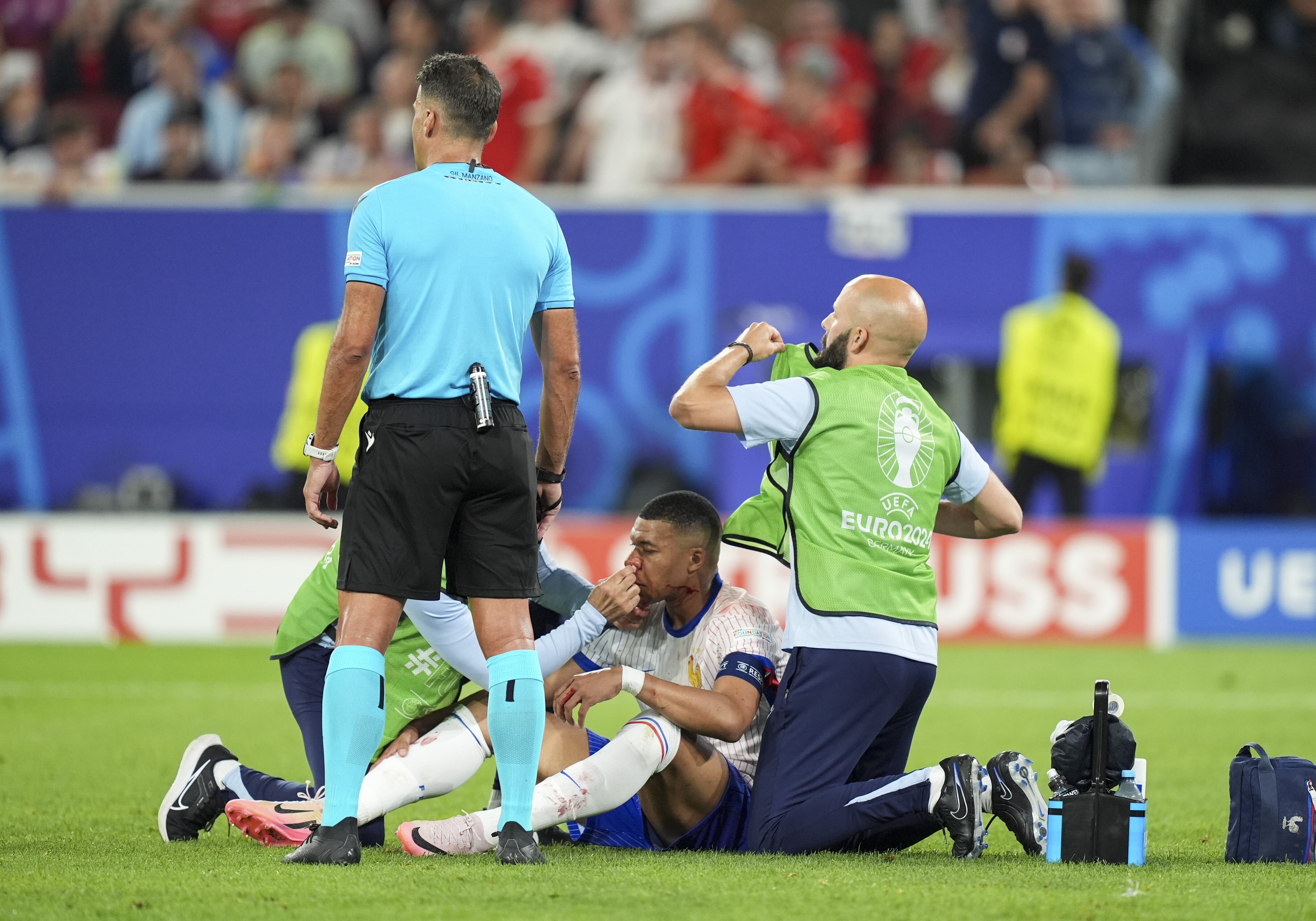 Durísimo diagnóstico: los partidos que se perderá Kylian Mbappé tras grave lesión ante Austria | Getty Images