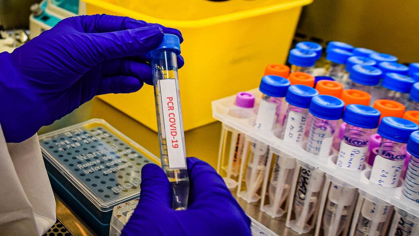 Coronavirus