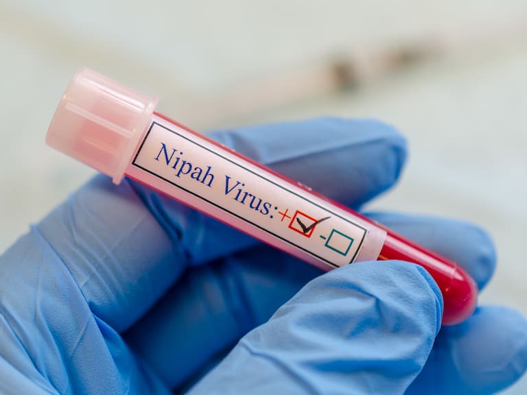 Qué es el virus Nipah y cuáles son sus síntomas: es incurable y puso en alerta a la India