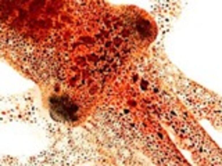 El pulpo ve a través de la piel