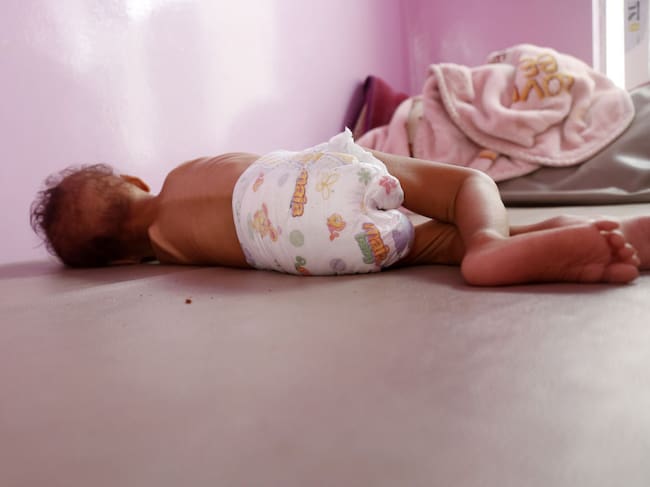 Un niño en Yemen enfrenta la desnutrición que sufre en plena crisis humanitaria