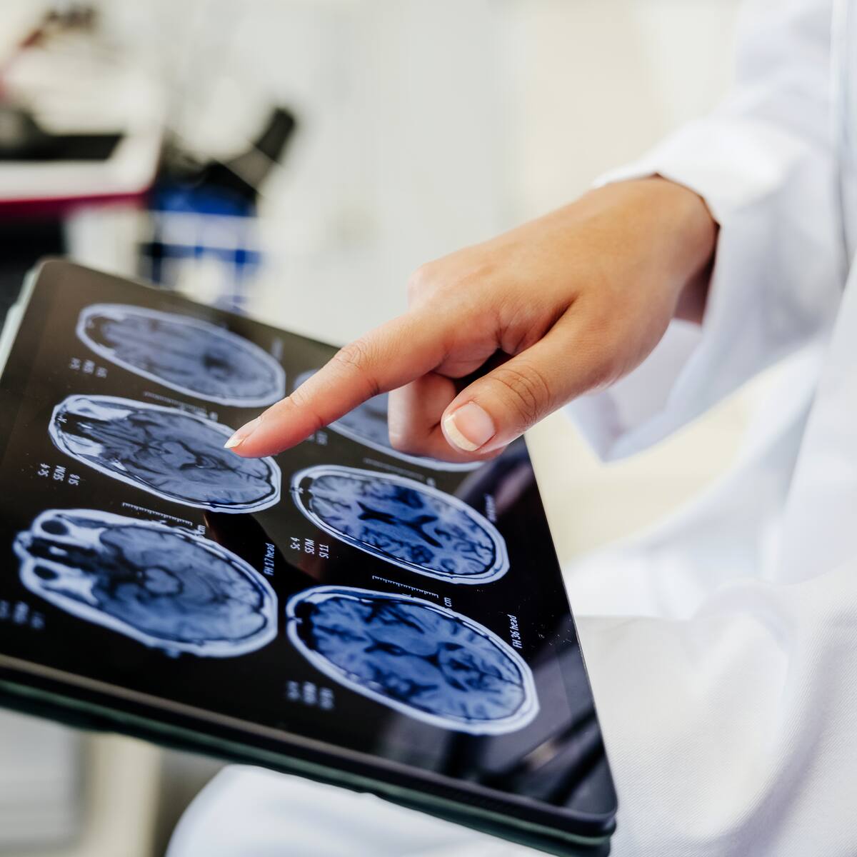 Esta fruta de verano de solo 30 calorías fortalece el sistema inmune, mejora la piel y protege el cerebro