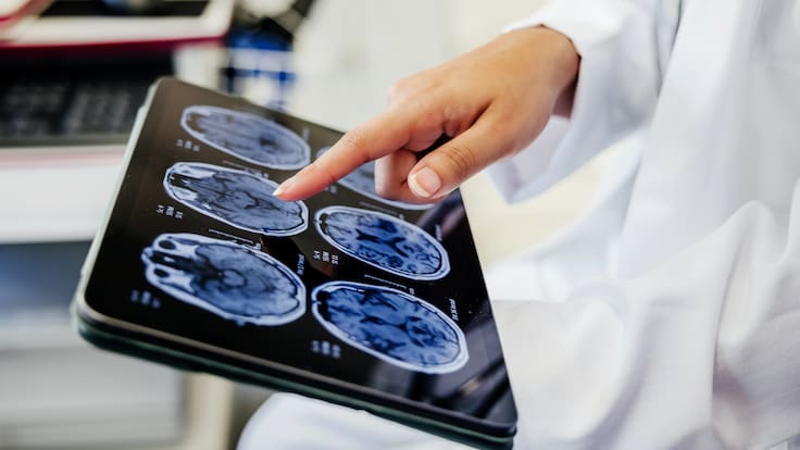 Esta fruta de verano de solo 30 calorías fortalece el sistema inmune, mejora la piel y protege el cerebro