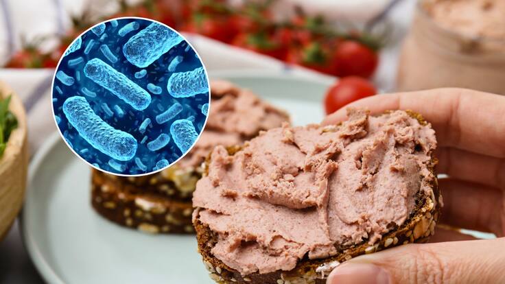 Qué es la Listeria, la bacteria encontrada en conocida marca de paté de jamón que alertó al Ministerio de Salud