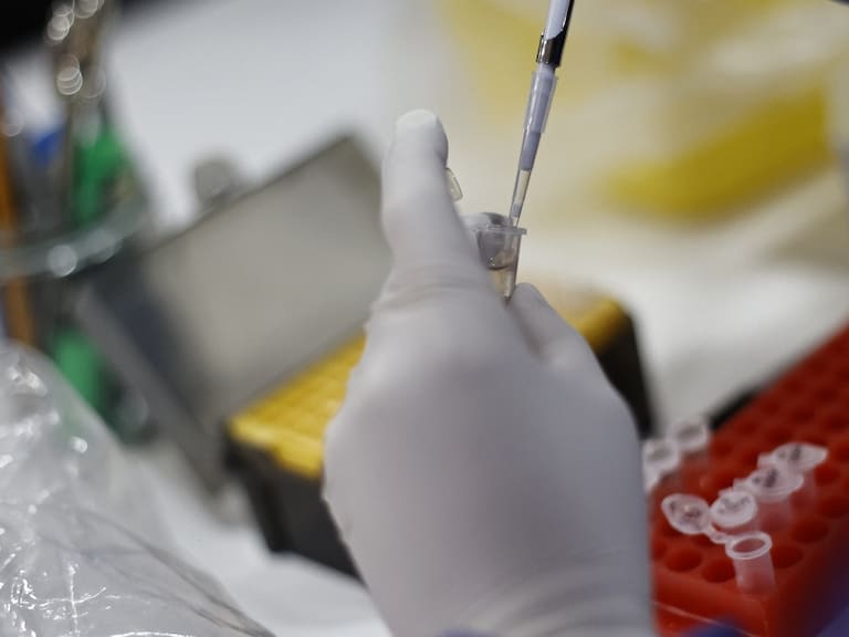 Viruela del mono en Chile: Ministerio de Salud actualiza a 189 los casos confirmados