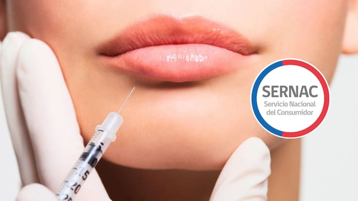 SERNAC alerta sobre riesgos en servicios estéticos en Chile: el 40% de los centros carece de autorización sanitaria