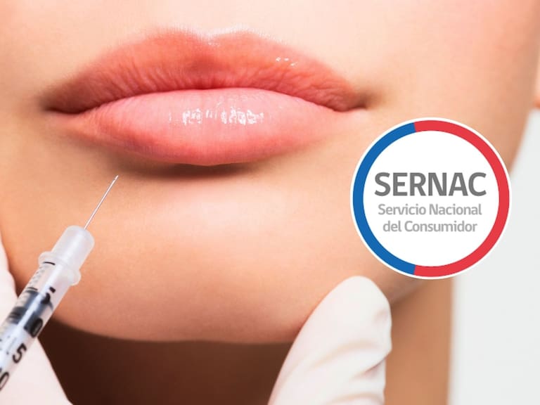 SERNAC alerta sobre riesgos en servicios estéticos en Chile: el 40% de los centros carece de autorización sanitaria