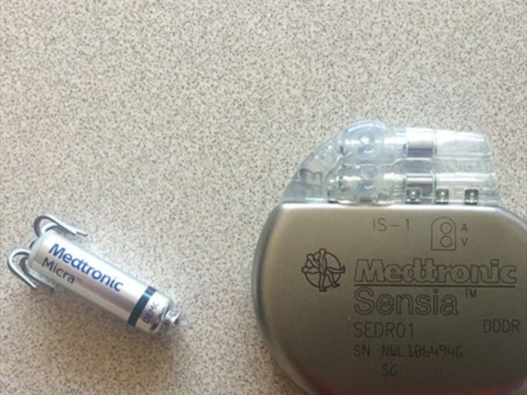 Instalan marcapasos del porte de una moneda de $100 a paciente del Hospital San José