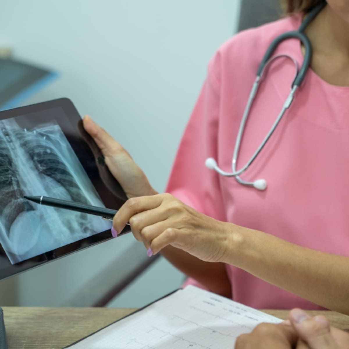 Alerta por tuberculosis en Chile: confirman tres contagios en Biobío y Coquimbo y activan protocolos de seguridad